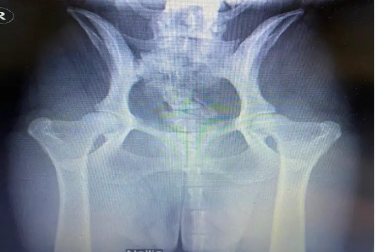 Hip Dysplasia in Poodles Causes, Prevention, and Treatment